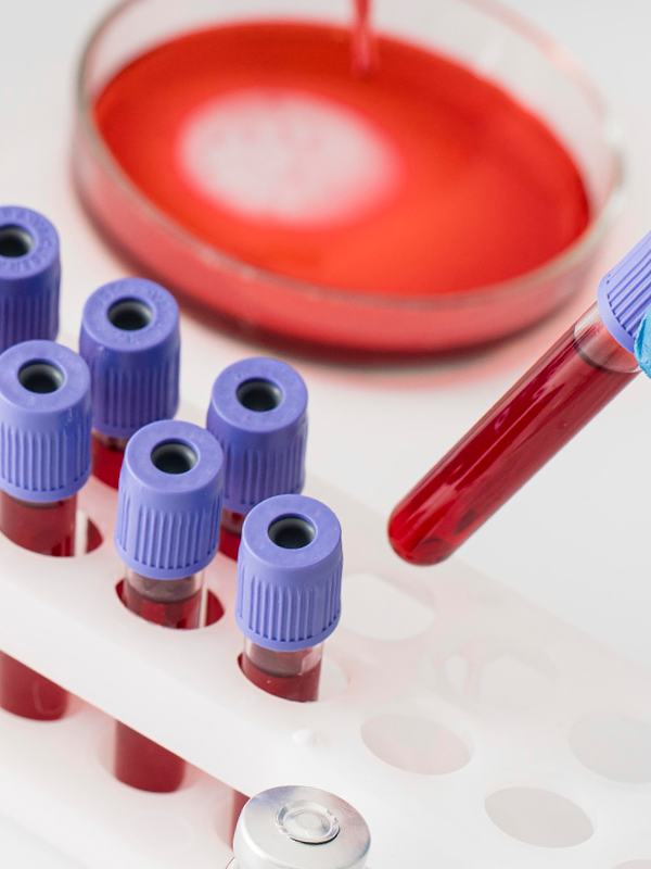 Blood samples staged for analysis, linked to the Cyrex Lymphocyte MAP Advanced Aids Screening.
